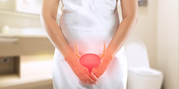 Kadın elleriyle alt karın bölgesini tutuyor, üzerinde mesane anatomisi çizimi var.